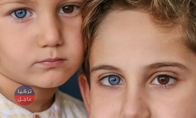 شقيقان لكل منهما عين زرقاء وأخرى بنية
