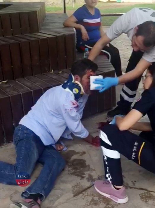 رجل يهشم أنف صديقه في أنطاليا بلكمة واحدة وهذا ماحل به (صور + فيديو)