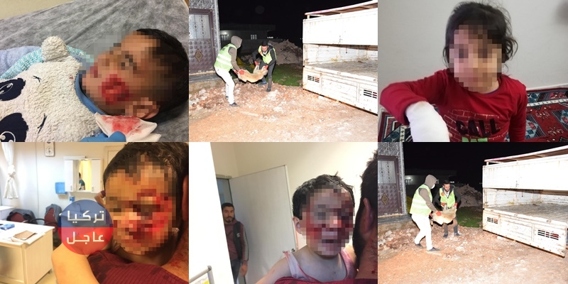 شاهد ماذا فعلت الكلاب الشاردة بـ 6 أطفال في شانلي إورفا (لن تصدق/ صور) شاهد ماذا فعلت الكلاب الشاردة بـ 6 أطفال في شانلي إورفا (لن تصدق/ صور)