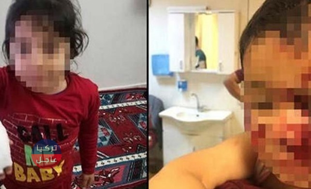 شاهد ماذا فعلت الكلاب الشاردة بـ 6 أطفال في شانلي إورفا (لن تصدق/ صور) شاهد ماذا فعلت الكلاب الشاردة بـ 6 أطفال في شانلي إورفا (لن تصدق/ صور)