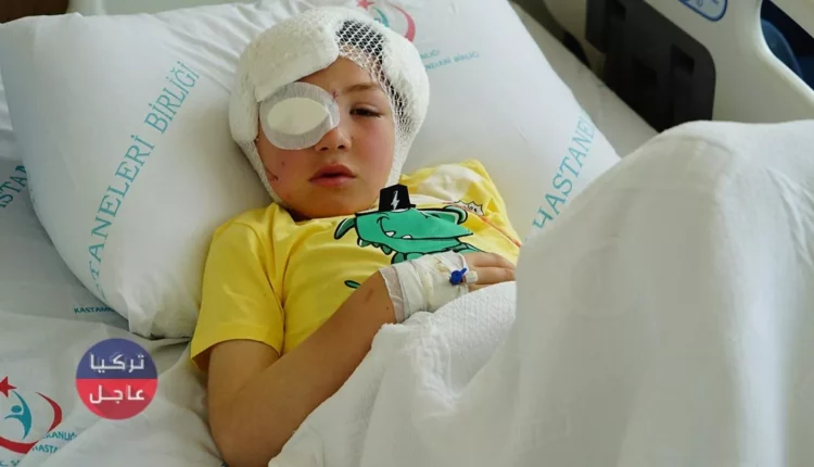 شاهد ماذا فعل كلب بطـ.ـفل في ولاية قسطموني التركية