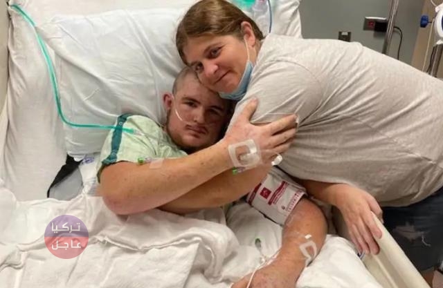 شاب يتعرض لـ 20 ألف لسعة من النحل وهذا ما حل به شاب يتعرض لـ 20 ألف لسعة من النحل وهذا ما حل به