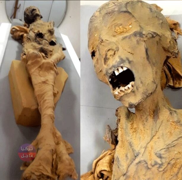 أخيرا حل لغز المومياء الصارخة.. مومياء لامرأة عمرها 3 ألاف سنة تظهر على وجهها علامات الرعب والألم والصراخ أخيرا حل لغز المومياء الصارخة.. مومياء لامرأة عمرها 3 ألاف سنة تظهر على وجهها علامات الرعب والألم والصراخ