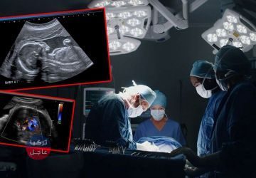 عملية جراحية تسجل في التاريخ! عملية جراحية لجنين في رحم أمه