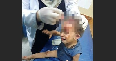 مذبحة أمام العالم! وأوضح طبيب من غزة الرعب: أطفال بجثث محترقة قادمون