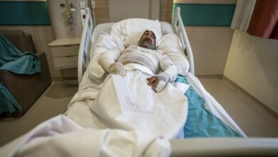 سيجارة تشعل شرفة منزل في تركيا وتحولها إلى كرة لهب.. ومصرع شخص بحروق بالغة