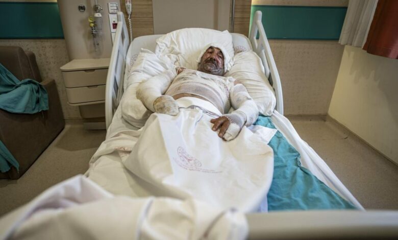 سيجارة تشعل شرفة منزل في تركيا وتحولها إلى كرة لهب.. ومصرع شخص بحروق بالغة