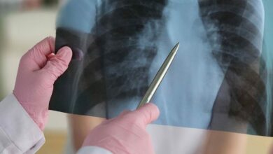 فرنسا تفتح تحقيقًا صحيًا وتتتبع المخالطين بعد رصد 3 إصابات بالسل في فال دو مارن