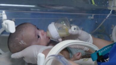طفل يولد بوزن 500 غرام في إسطنبول ويخرج من المستشفى بعد رحلة علاج استمرت 5 أشهر