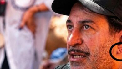 علامة فرانك في شحمة الأذن ليست دليلاً على قرب النوبة القلبية