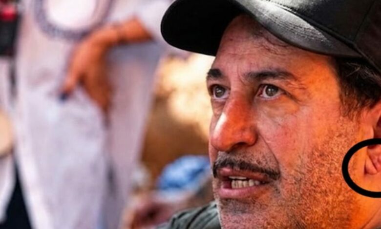 علامة فرانك في شحمة الأذن ليست دليلاً على قرب النوبة القلبية