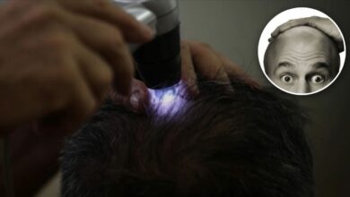 زيادة تساقط الشعر في الخريف لا تعني فقدانه نهائياً.. متى يحتاج الأمر إلى فحص؟