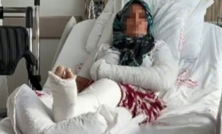 مطاردة نجلها سبقت الاعتداء عليها.. كسر ذراع وساق امرأة في مرسين التركية وتوقيف 4 مشتبهين