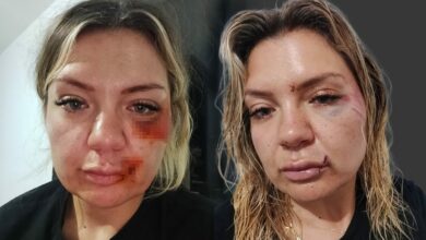 انكسر نصل السكين أثناء طعنها.. النيابة التركية تطلب محاكمة مهاجم امرأة بتهمة محاولة القتل
