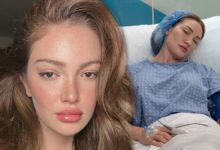 دانلا بيليتش تخضع لعمليتها التاسعة وتقول بعد 6 ساعات: «أشعر كأنني وُلدت من جديد»