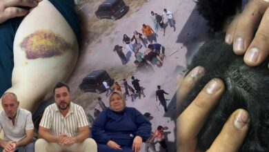 إصابة 3 من عائلة واحدة في شجار بالسلاسل والفؤوس والسكاكين في أضنة التركية