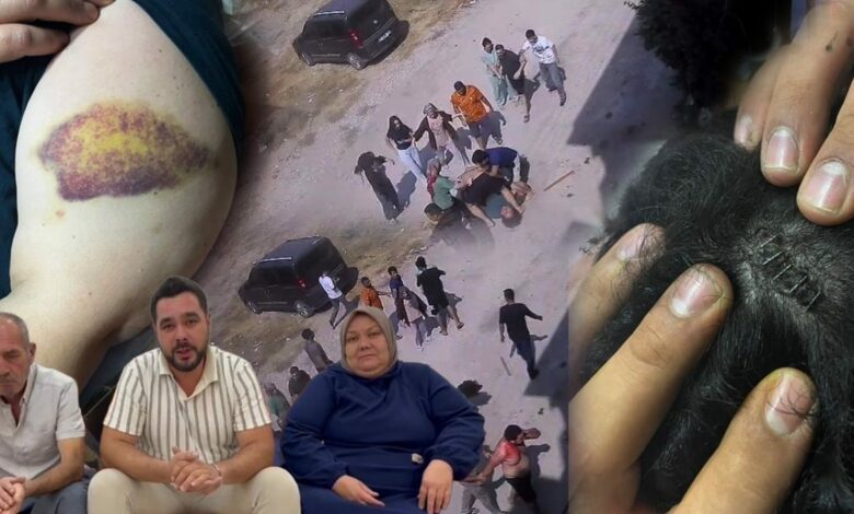 إصابة 3 من عائلة واحدة في شجار بالسلاسل والفؤوس والسكاكين في أضنة التركية