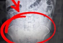 ابتلعوا أكثر من كيلوغرام من المخدرات لإخفائه.. المحكمة تأمر بسجن 4 مشتبه بهم في أكسراي التركية