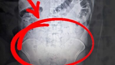 ابتلعوا أكثر من كيلوغرام من المخدرات لإخفائه.. المحكمة تأمر بسجن 4 مشتبه بهم في أكسراي التركية