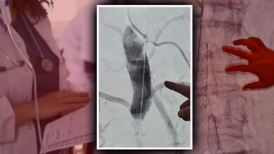 انسداد كامل لشريان رئيسي يكشف سبب آلام مريض كان يستعد لجراحة ظهر في Ereğli التركية