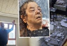 انهارت لياسة السقف فوقها أثناء مشاهدة التلفاز.. مسنّة تركية تفقد إحدى عينيها
