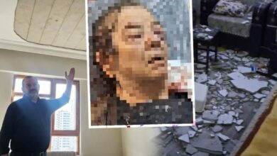 انهارت لياسة السقف فوقها أثناء مشاهدة التلفاز.. مسنّة تركية تفقد إحدى عينيها