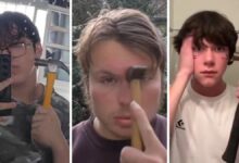 ضربات بالمطارق بحثًا عن ملامح حادة.. اتجاه تجميلي روسي يُنسب إليه إصابة أكثر من 100 شخص